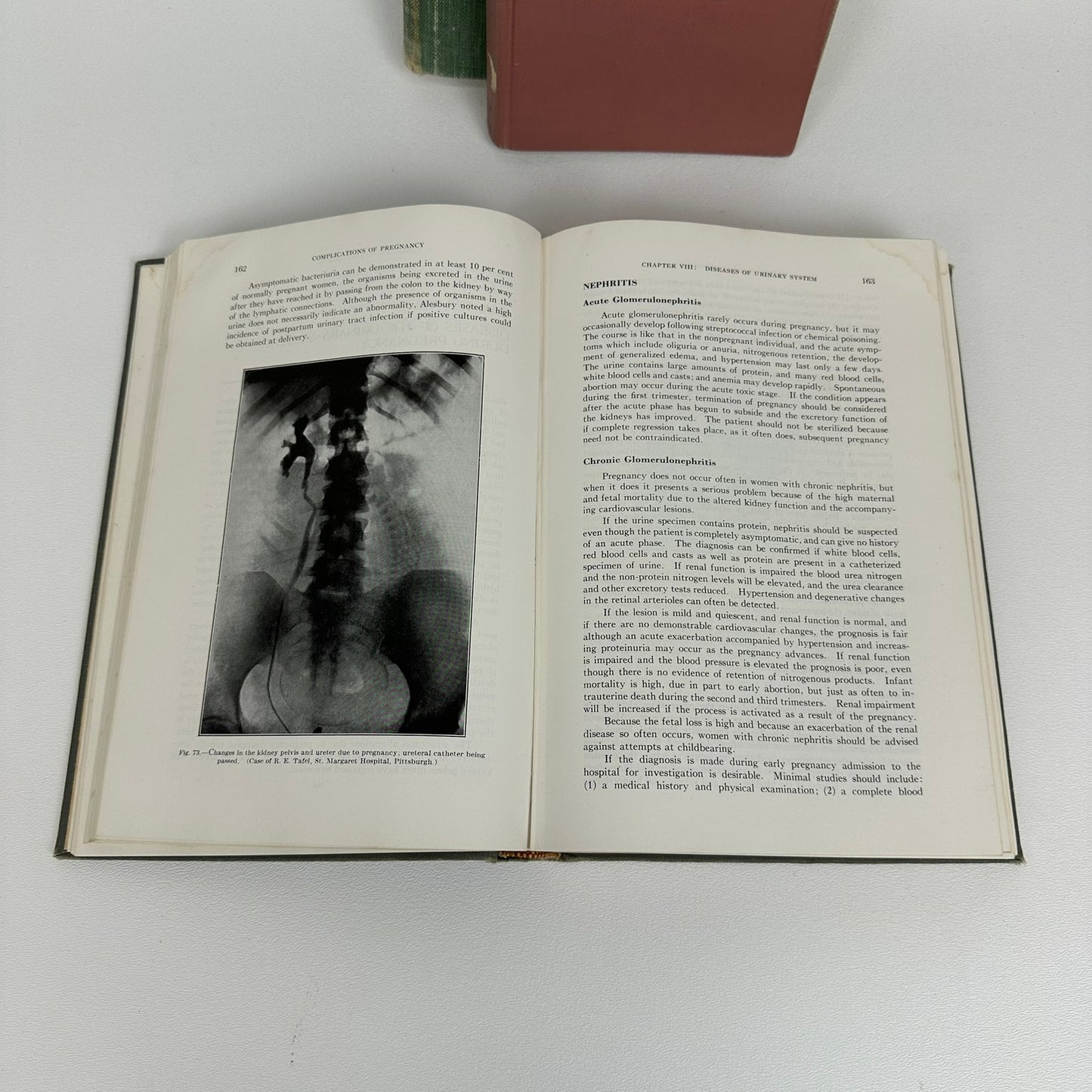 Obstetrics and Gynecology Lot of 3 J P Greenhill Paul Titus Medical Reference